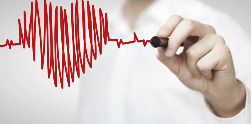<p>drawing chart heartbeat</p>
